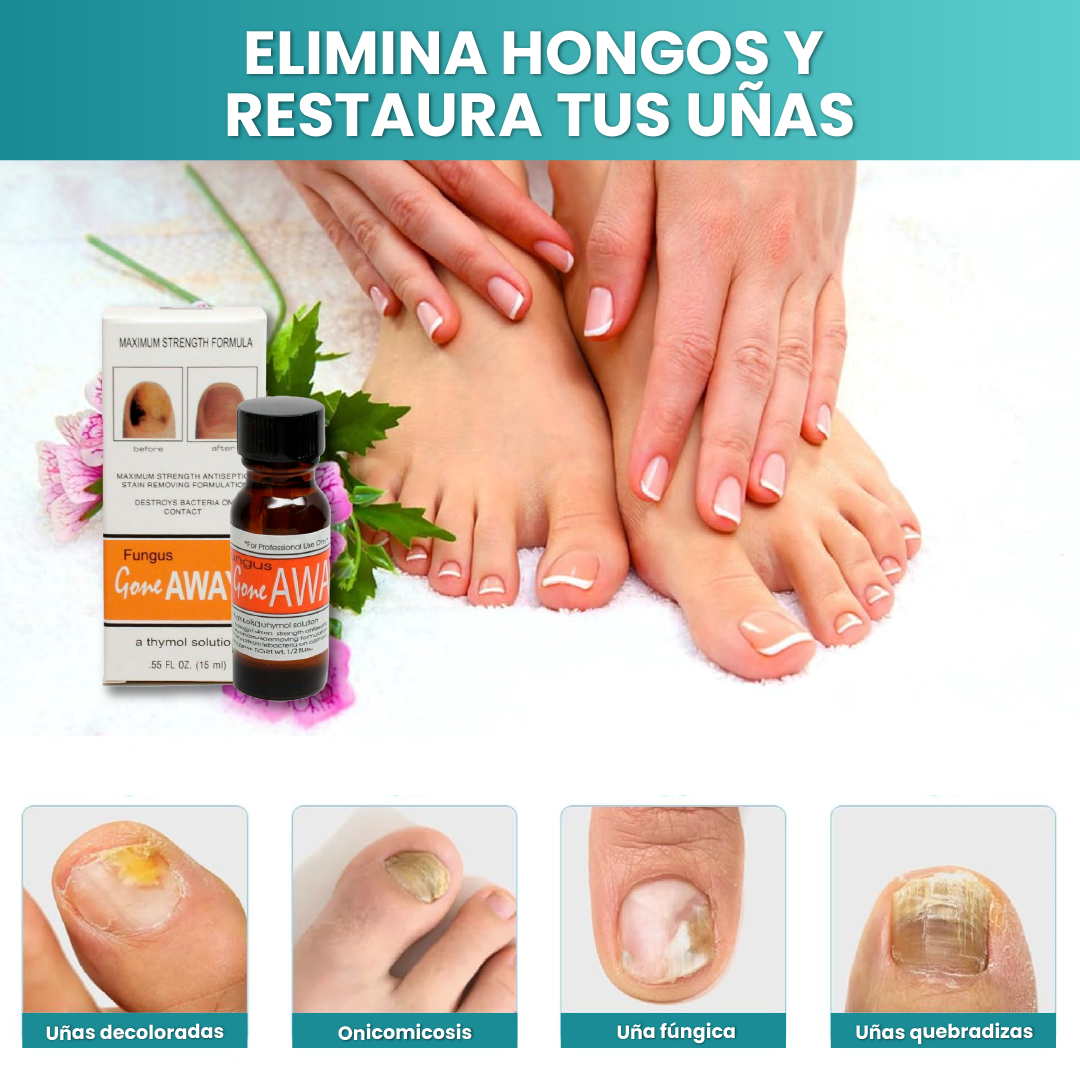 TRATAMIENTO ANTIHONGOS