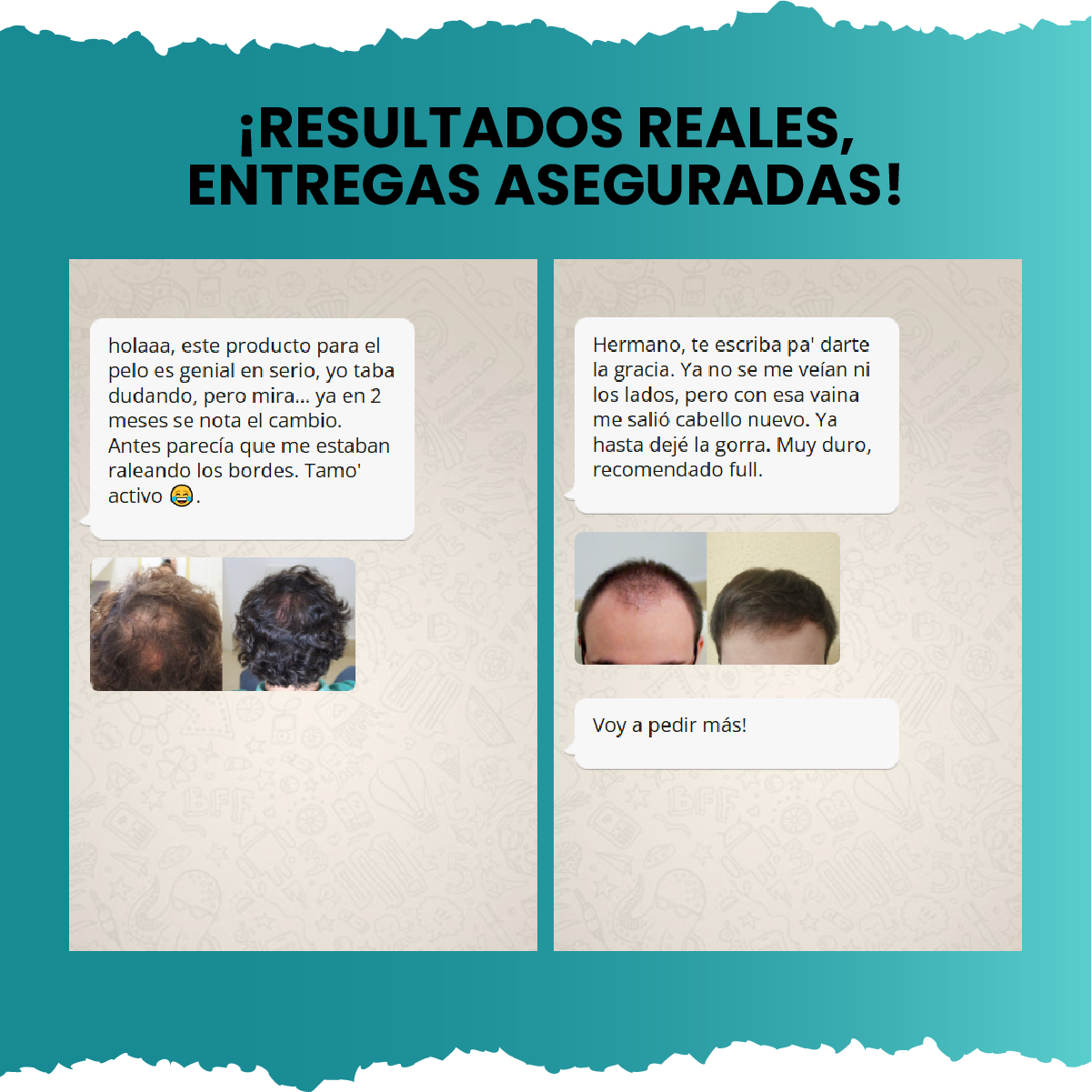 Suero Crecimiento Capilar