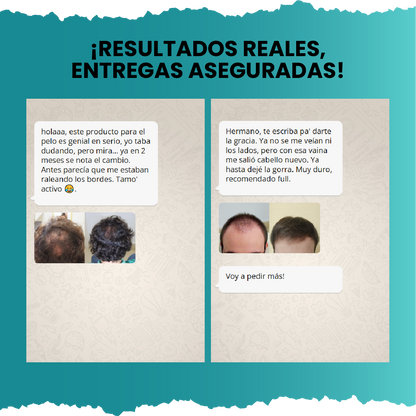 Suero Crecimiento Capilar