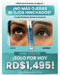 Rodillo Antiojeras