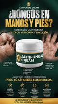 Antifungal Cream