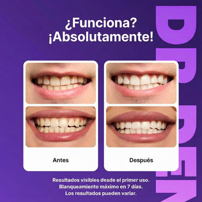 Tiras Blanqueadoras